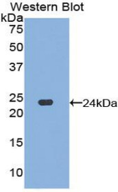 Western Blot; Sample: Recombinant protein.