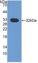 Western Blot; Sample: Recombinant CHIT1, Mouse.