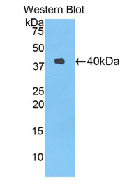 Western Blot; Sample: Recombinant protein.