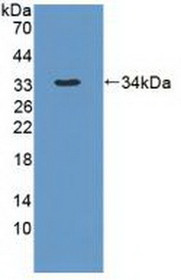 Western Blot; Sample: Recombinant DYNC1H1, Human.