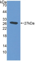 Western Blot; Sample: Recombinant protein.