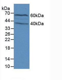 Western Blot; Sample: Mouse Brain Tissue.