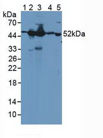 Western Blot; Sample: Lane1: Human Serum; Lane2: Human Hela Cells; Lane3: Mouse Brain Tissue; Lane4: Mouse Kidney Tissue; Lane5: Bovine Brain Tissue.