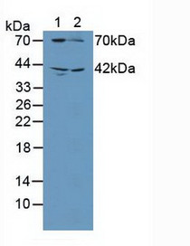 Western Blot; Sample: Lane1: Human Blood Platelet Cells; Lane2: Rat Brain Tissue.