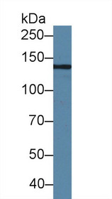 Western Blot; Sample: Human Serum; Primary Ab: 2µg/ml Rabbit Anti-Human HEPH Antibody Second Ab: 0.2µg/mL HRP-Linked Caprine Anti-Rabbit IgG Polyclonal Antibody