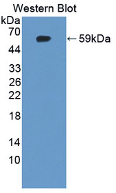 Western Blot; Sample: Recombinant protein.