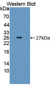 Western Blot; Sample: Recombinant protein.