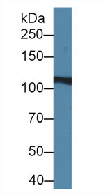 Western Blot; Sample: Rat Liver lysate; Primary Ab: 2µg/ml Rabbit Anti-Rat IREB2 Antibody Second Ab: 0.2µg/mL HRP-Linked Caprine Anti-Rabbit IgG Polyclonal Antibody