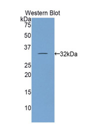 Western Blot; Sample: Recombinant protein.