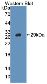 Western Blot; Sample: Recombinant protein.
