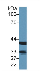 Western Blot; Sample: Rat Lymph node lysate; Primary Ab: 1µg/ml Rabbit Anti-Human LMAN2 Antibody Second Ab: 0.2µg/mL HRP-Linked Caprine Anti-Rabbit IgG Polyclonal Antibody