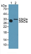 Western Blot; Sample: Lane1: Mouse Serum; Lane2: Mouse Heart Tissue.