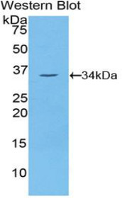 Western Blot; Sample: Recombinant protein.