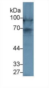 Western Blot; Sample: Rat Heart lysate; Primary Ab: 1µg/ml Rabbit Anti-Rat NEXN Antibody Second Ab: 0.2µg/mL HRP-Linked Caprine Anti-Rabbit IgG Polyclonal Antibody