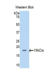 Western Blot; Sample: Recombinant protein.