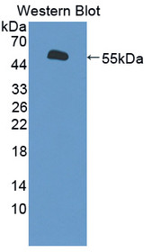 Western Blot; Sample: Recombinant protein.