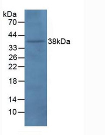 Western Blot; Sample: Rat Brain Tissue.