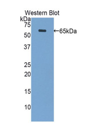 Western Blot; Sample: Recombinant protein.