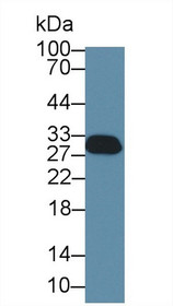 Western Blot; Sample: Rat Cerebrum lysate; ;Primary Ab: 1µg/ml Rabbit Anti-Human SFN Antibody;Second Ab: 0.2µg/mL HRP-Linked Caprine Anti-Rabbit IgG Polyclonal Antibody;