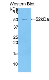 Western Blot; Sample: Recombinant protein.