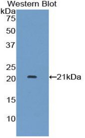 Western Blot; Sample: Recombinant protein.