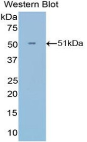 Western Blot; Sample: Recombinant protein.