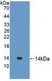 Western Blot; Sample: Recombinant UBQLN2, Human.