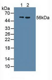 Western Blot; Sample: Lane1: Human Urine; Lane2: Human Serum.