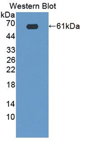 Western Blot; Sample: Recombinant protein.