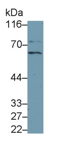 Western Blot; Sample: Recombinant protein.