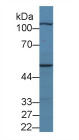 Western Blot; Sample: Porcine Skeletal muscle lysate; Primary Ab: 2µg/ml Rabbit Anti-Human MYPN Antibody Second Ab: 0.2µg/mL HRP-Linked Caprine Anti-Rabbit IgG Polyclonal Antibody