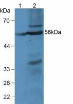 Western Blot; Sample: Lane1: Rat Liver Tissue; Lane2: Mouse Liver Tissue.