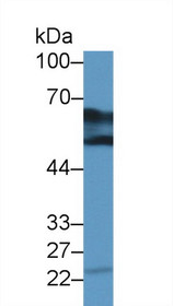 Western Blot; Sample: Bovine Kidney lysate; Primary Ab: 2µg/ml Rabbit Anti-Human DDC Antibody Second Ab: 0.2µg/mL HRP-Linked Caprine Anti-Rabbit IgG Polyclonal Antibody