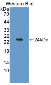 Western Blot; Sample: Recombinant protein.