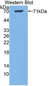 Western Blot; Sample: Recombinant protein.