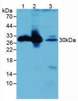Western Blot; Sample: Lane1: Mouse Brain Tissue; Lane2: Mouse Kidney Tissue; Lane3: Mouse Eye Tissue.