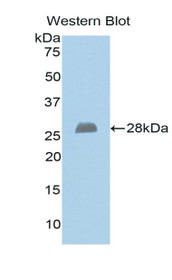 Western Blot; Sample: Recombinant protein.