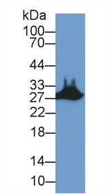 Western Blot; Sample: Mouse Skeletal muscle lysate; Primary Ab: 2µg/ml Rabbit Anti-Human STC2 Antibody Second Ab: 0.2µg/mL HRP-Linked Caprine Anti-Rabbit IgG Polyclonal Antibody
