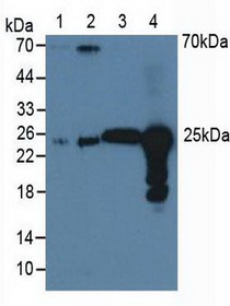 Western Blot; Sample: Lane1: Human A549 Cells; Lane2: Human Hela Cells; Lane3: Bovine Liver Tissue; Lane4: Bovine Lung Tissue.