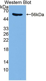 Western Blot; Sample: Recombinant protein.