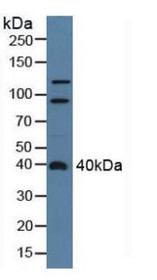 Western Blot; Sample: Rat Serum.
