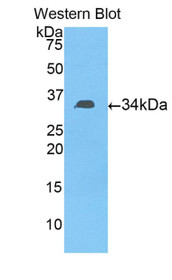 Western Blot; Sample: Recombinant protein.