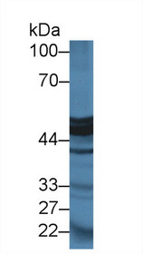 Western Blot; Sample: Mouse Pancreas lysate; Primary Ab: 2µg/ml Rabbit Anti-Rat CPA1 Antibody Second Ab: 0.2µg/mL HRP-Linked Caprine Anti-Rabbit IgG Polyclonal Antibody