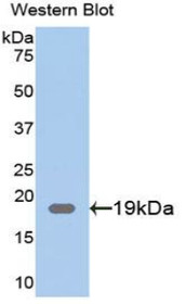 Western Blot; Sample: Recombinant protein.