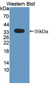 Western Blot; Sample: Recombinant protein.