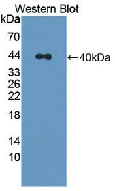 Western Blot; Sample: Recombinant protein.