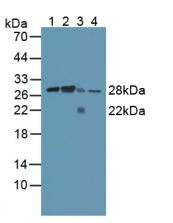 Western Blot; Sample: Lane1: Human Lung Tissue; Lane2: Human Blood Cells; Lane3: Human A431 Cells; Lane4: Mouse Spleen Tissue.