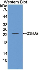 Western Blot; Sample: Recombinant protein.