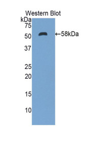 Western Blot; Sample: Recombinant protein.