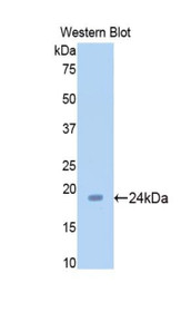 Western Blot; Sample: Recombinant protein.